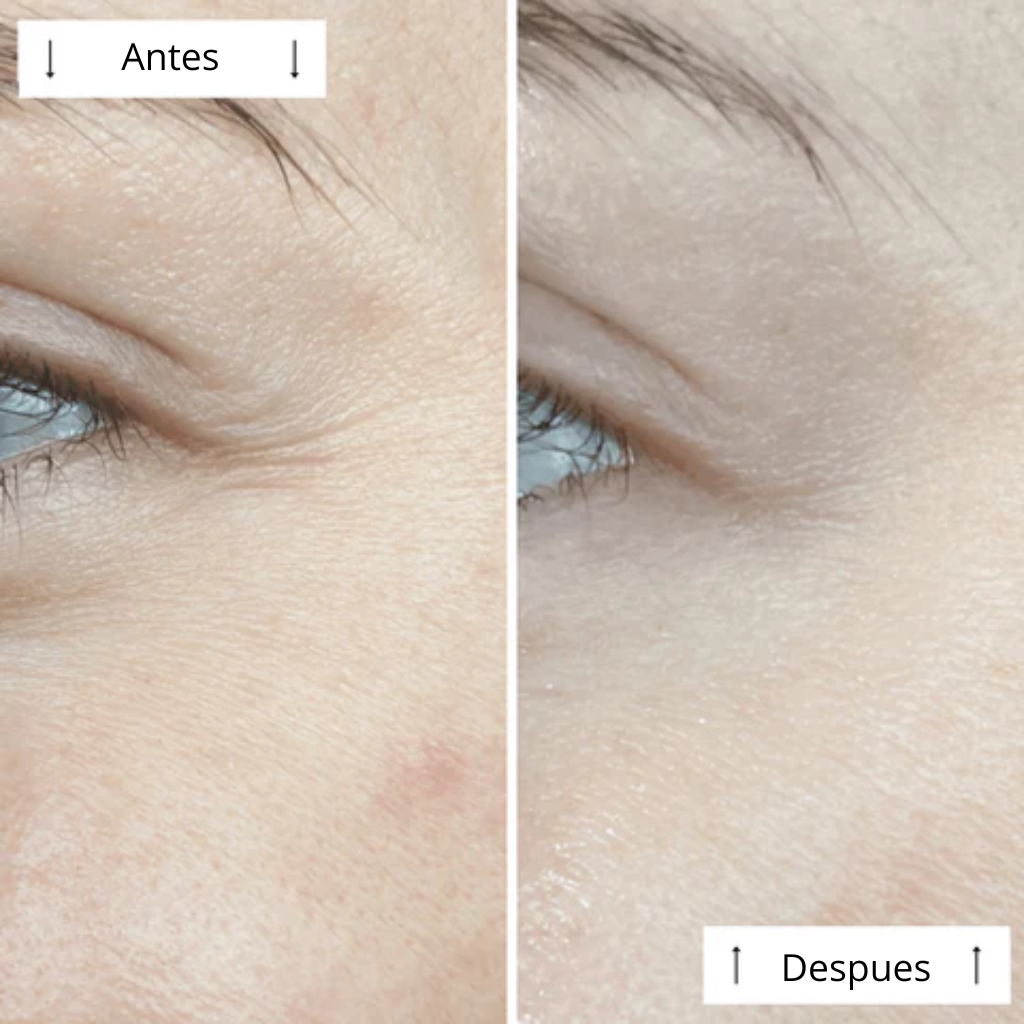 Máscara de contorno LED DERMALUX  | Piel perfecta en 30 días